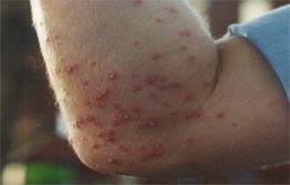 The horrors of red imported fire ants